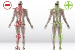 Illustration des impacts d'une mauvaise posture